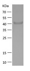    JMJD6 / Recombinant Human JMJD6