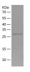    TTC33 / Recombinant Human TTC33