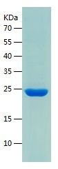    Betatrophin / Recombinant Human Betatrophin
