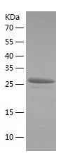    ZNF562 / Recombinant Human ZNF562