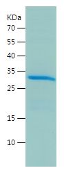    Lin28B / Recombinant Human Lin28B