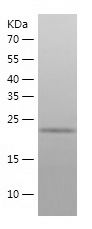    UBC3B / Recombinant Human UBC3B