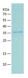    Dppa4 / Recombinant Human Dppa4