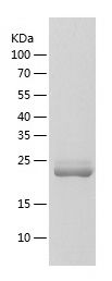    MOB4A / Recombinant Human MOB4A