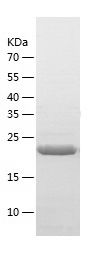    KDM3B / Recombinant Human KDM3B