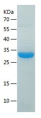    DCXR / Recombinant Human DCXR