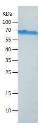    PRRT2 / Recombinant Human PRRT2