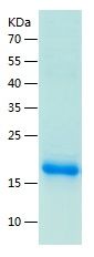    ADAT2 / Recombinant Human ADAT2