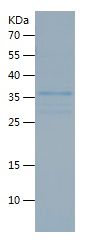 Recombinant Mouse Thrombospondin 1