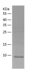    SLC51B / Recombinant Human SLC51B