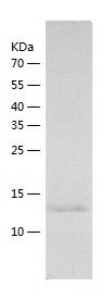    ITIH5 / Recombinant Human ITIH5