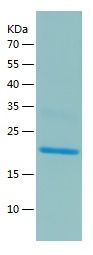    MDP1 / Recombinant Human MDP1