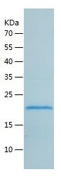    GKN2 / Recombinant Human GKN2