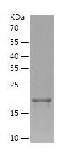    Uridine Phosphorylase 1 / Recombinant Human Uridine Phosphorylase 1