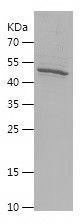    PLCZ1 / Recombinant Human PLCZ1