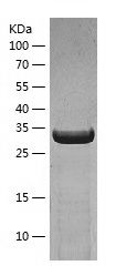 Recombinant Mouse AHA1