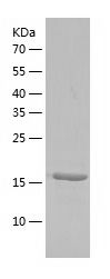    TGIF2LY / Recombinant Human TGIF2LY