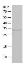    TPH2 / Recombinant Human TPH2