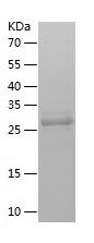    TR-1 / Recombinant Human TR-1