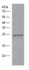    GPR114 / Recombinant Human GPR114