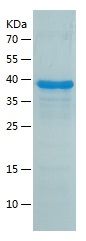    REXO1 / Recombinant Human REXO1