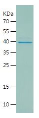    SIRT6 / Recombinant Human SIRT6