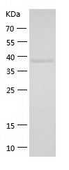    ASCC1 / Recombinant Human ASCC1