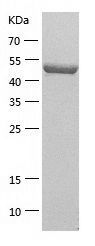    MLKL / Recombinant Human MLKL