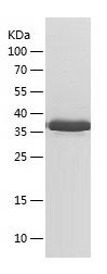    GOLPH2 / Recombinant Human GOLPH2