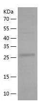    ZNF439 / Recombinant Human ZNF439