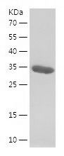    FDCSP / Recombinant Human FDCSP