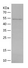    ANGPTL6 / Recombinant Human ANGPTL6