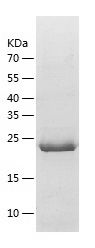    ANKRD50 / Recombinant Human ANKRD50