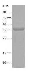    FANK1 / Recombinant Human FANK1