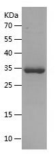    NEK7 / Recombinant Human NEK7