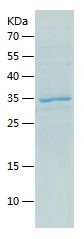    DDI1 / Recombinant Human DDI1