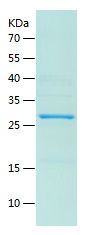    TGFBRAP1 / Recombinant Human TGFBRAP1