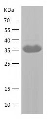    Migfilin / Recombinant Human Migfilin