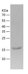    CHAC2 / Recombinant Human CHAC2