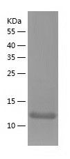    PHIP / Recombinant Human PHIP