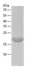    JDP2 / Recombinant Human JDP2