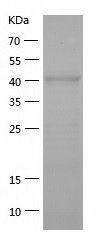    ATG4A / Recombinant Human ATG4A