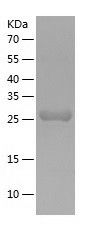    DCUN1D4 / Recombinant Human DCUN1D4