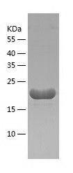    AP3S1 / Recombinant Human AP3S1