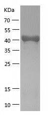    NDRG1 / Recombinant Human NDRG1