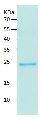    PROX1 / Recombinant Human PROX1