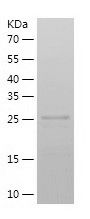    GGH / Recombinant Human GGH