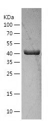    KAT2B / Recombinant Human KAT2B