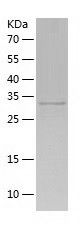    UFD1L / Recombinant Human UFD1L