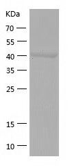    GCDH / Recombinant Human GCDH